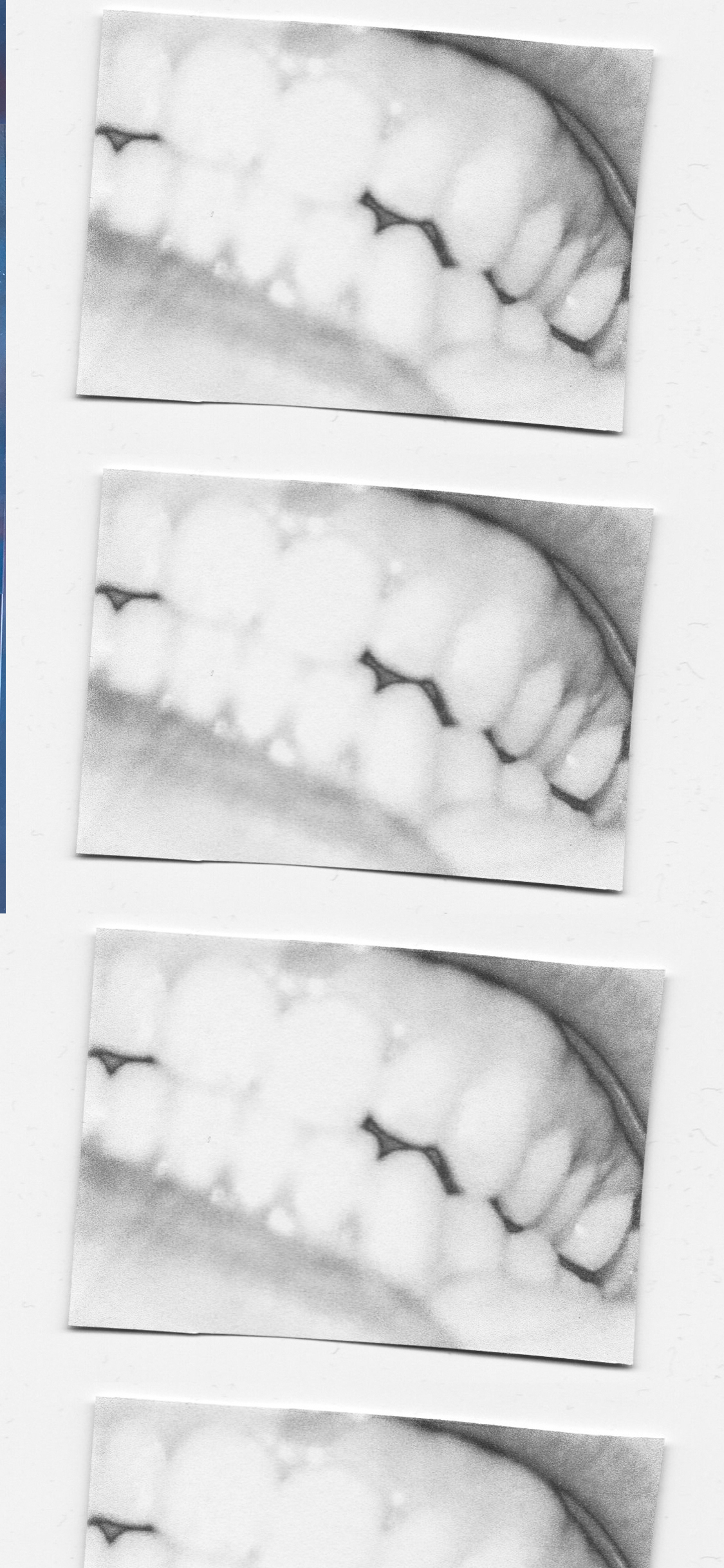 A pair of teeth up close with high saturation. The photo is in color.